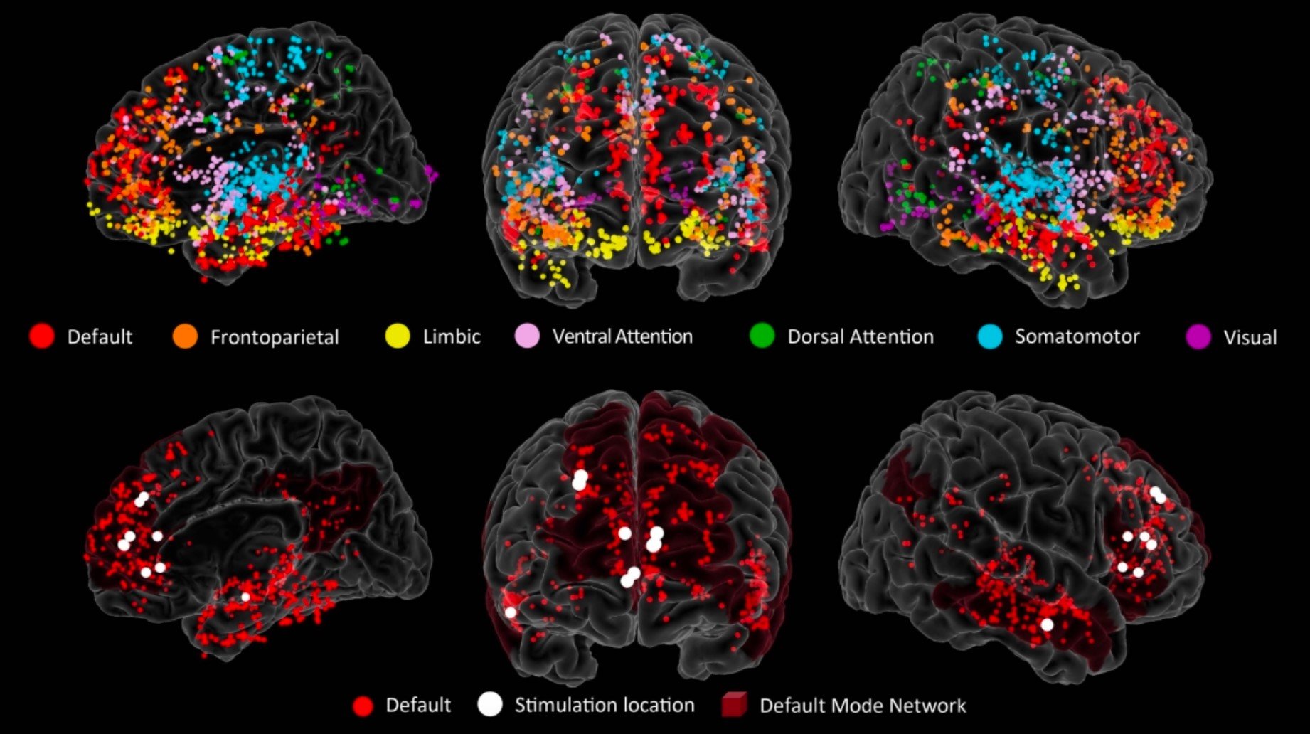 Electrodes Deep Brain Stim