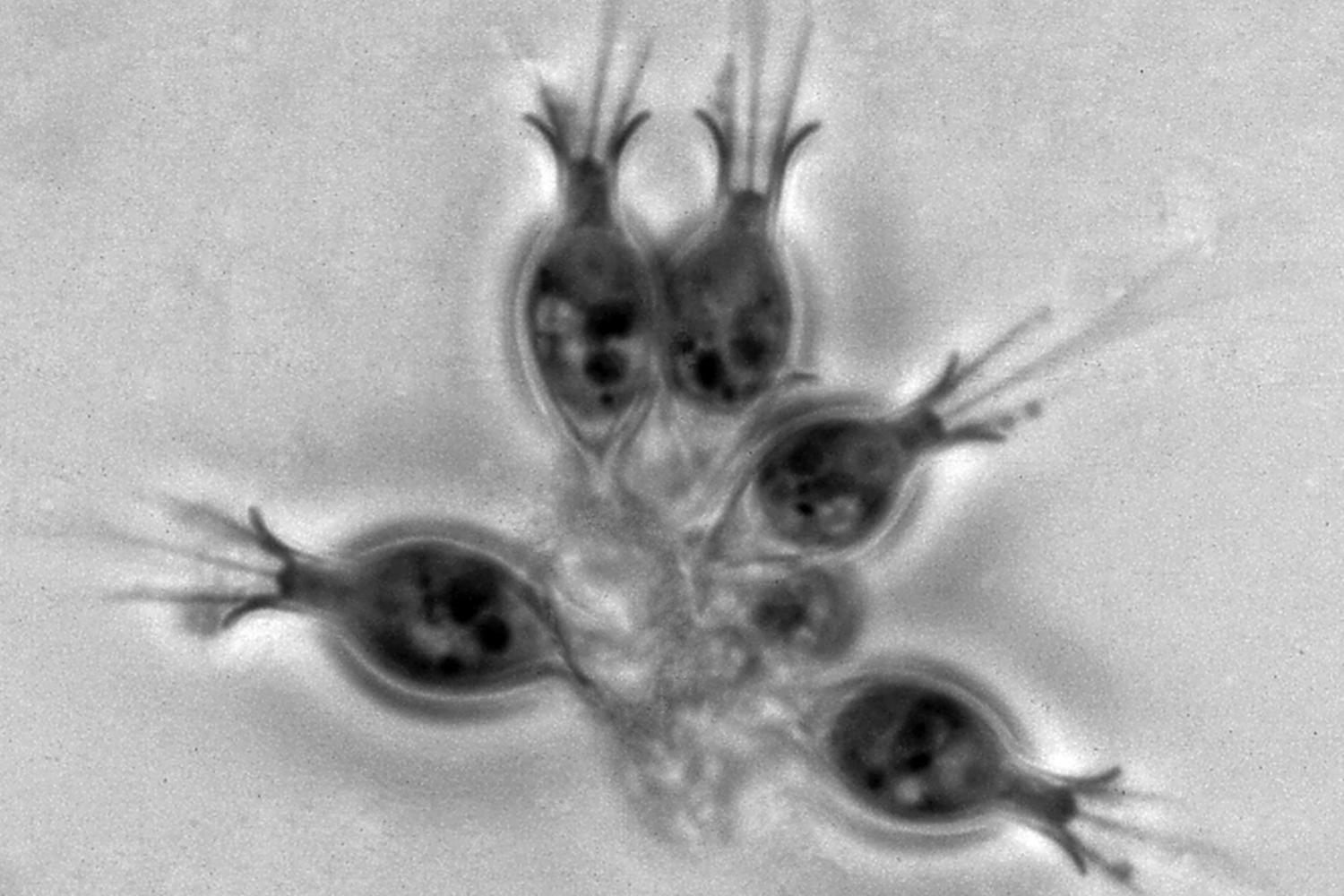 Choanoflagellés