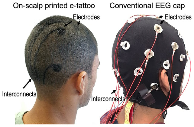 Eeg Encre Vs électrodes