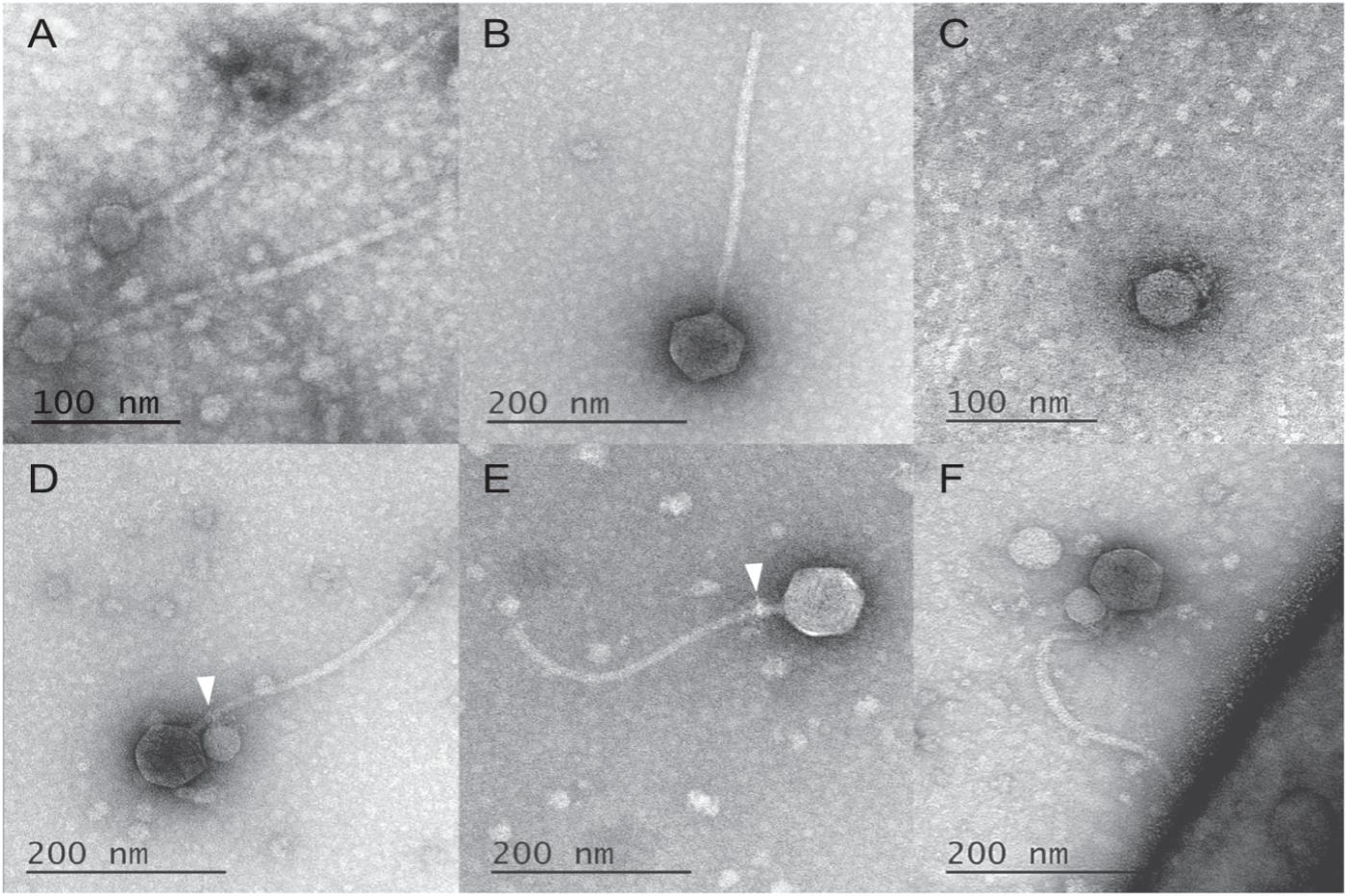 Virus satellite attaché vu au microscope électronique